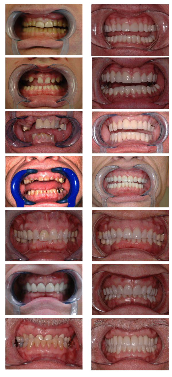 Gallery Dentist in Prescott, AZ