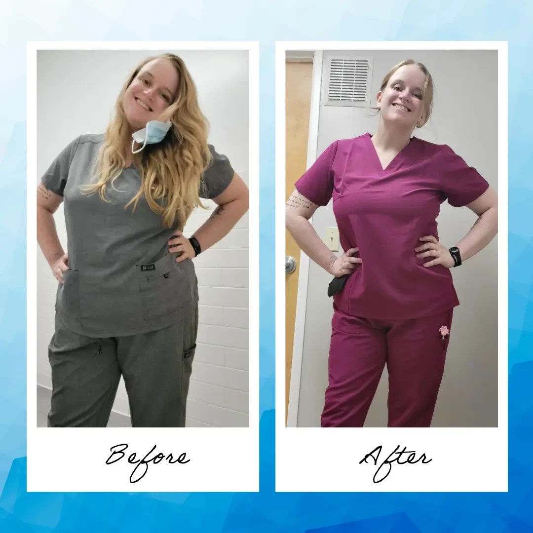 Wegovy Weight Loss before And After Pictures Stunning Results My Blog