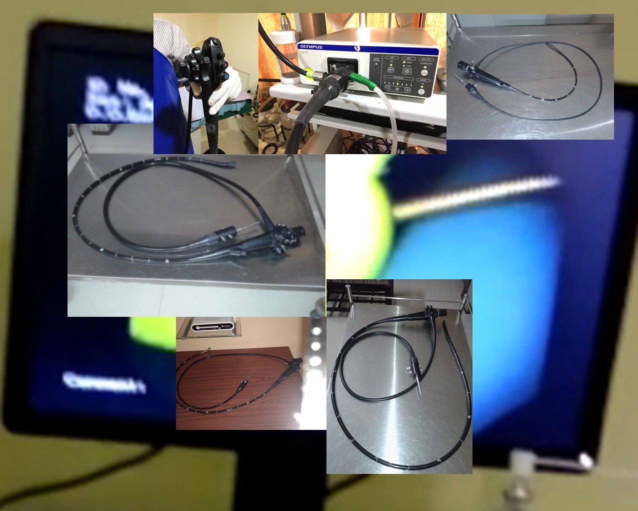 What is endoscopy? What are the different organs examined using an