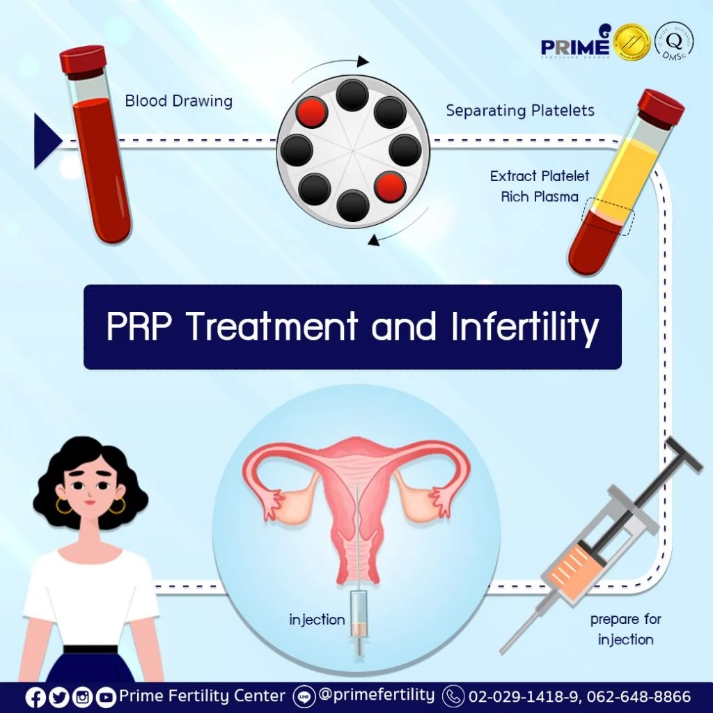PRP Treatment and Infertility Thailand IVF/ICSI/IUI
