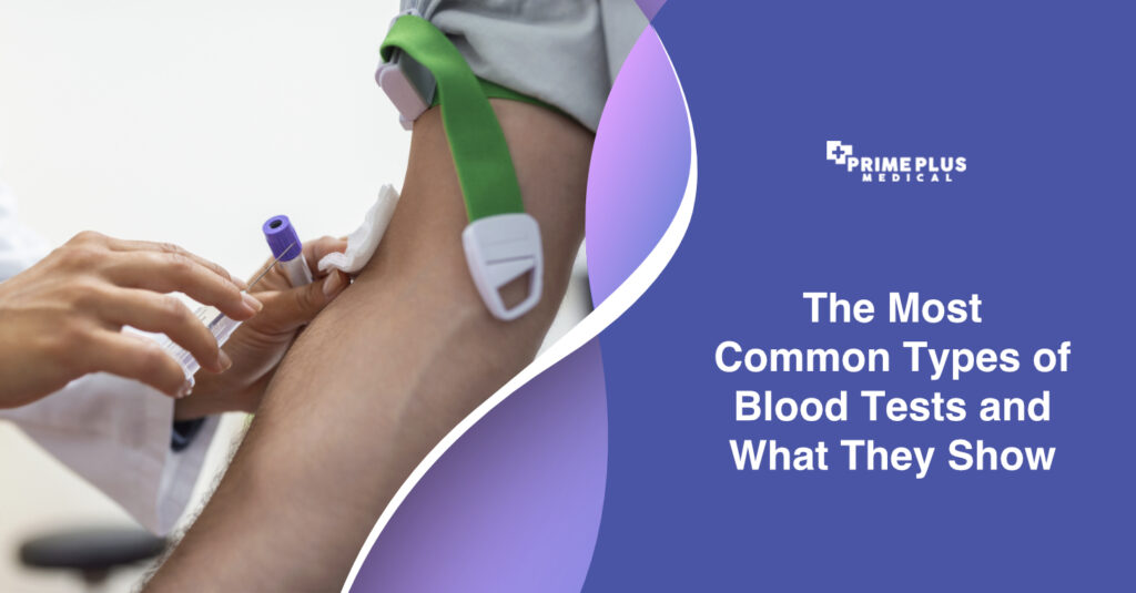 The Most Common Types of Blood Tests Prime Plus Medical