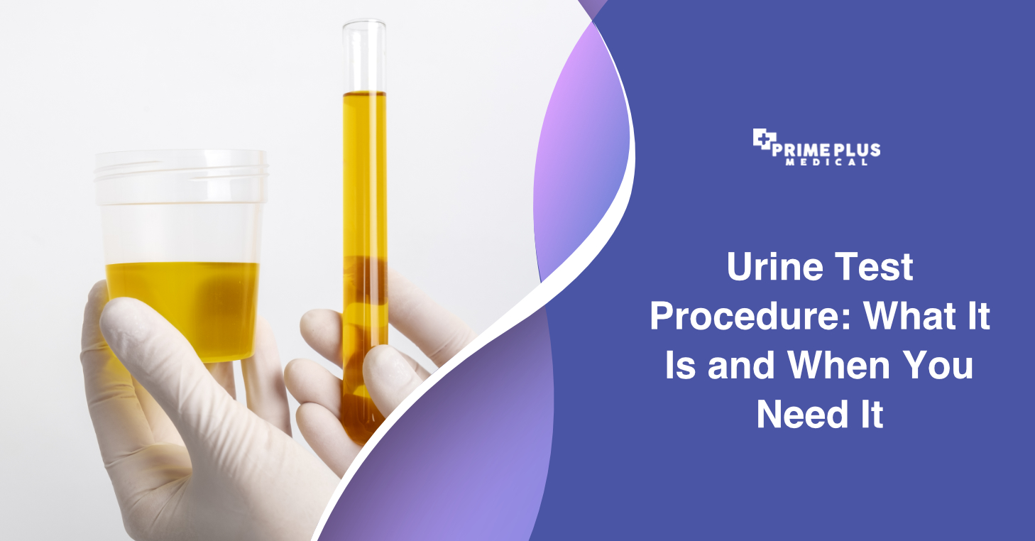 Urine Test Procedure When You Need It Prime Plus Medical