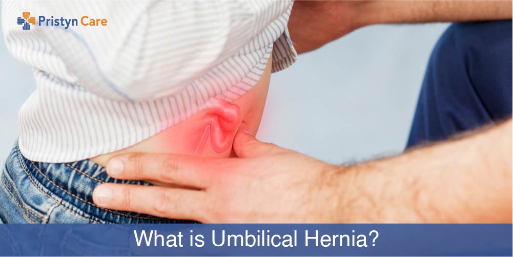 Hernia Normal Baby Belly Button Umbilical Hernia Belt Baby Belly