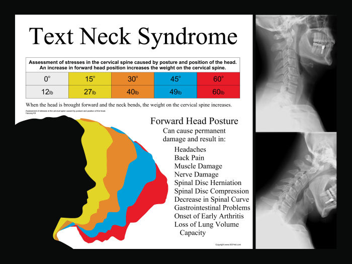 Mobile phones.... A modern day pain in the neck? PhysioMAX Wellness