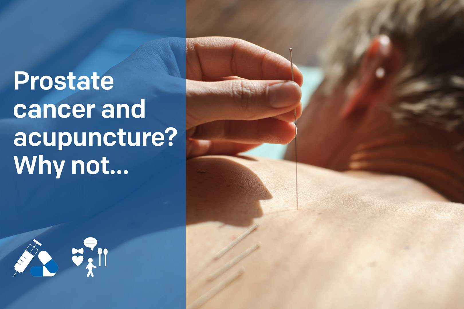 Prostate cancer and acupuncture? Why not…