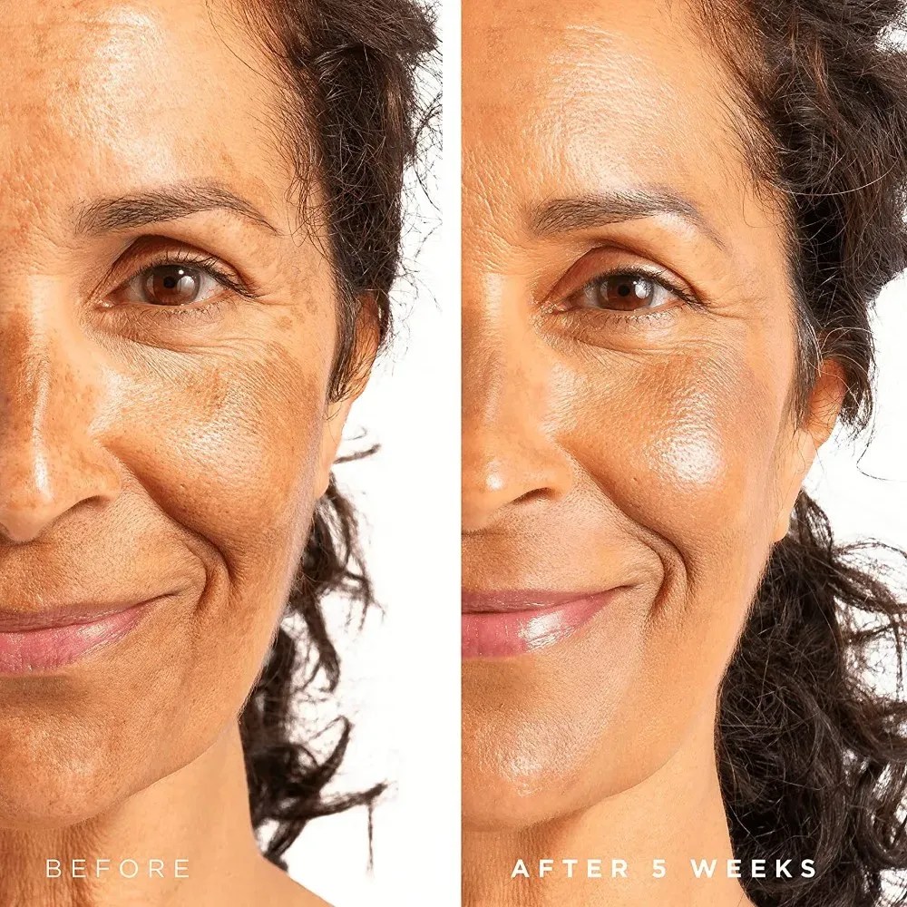 5 Niacinamide and Hyaluronic Acid Serums The Ultimate SkinSaving Combo!