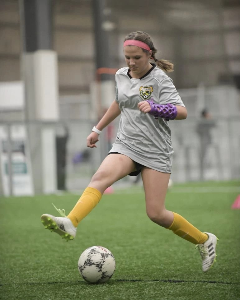 Can You Play Soccer With A Cast? (SOCCER RULES)