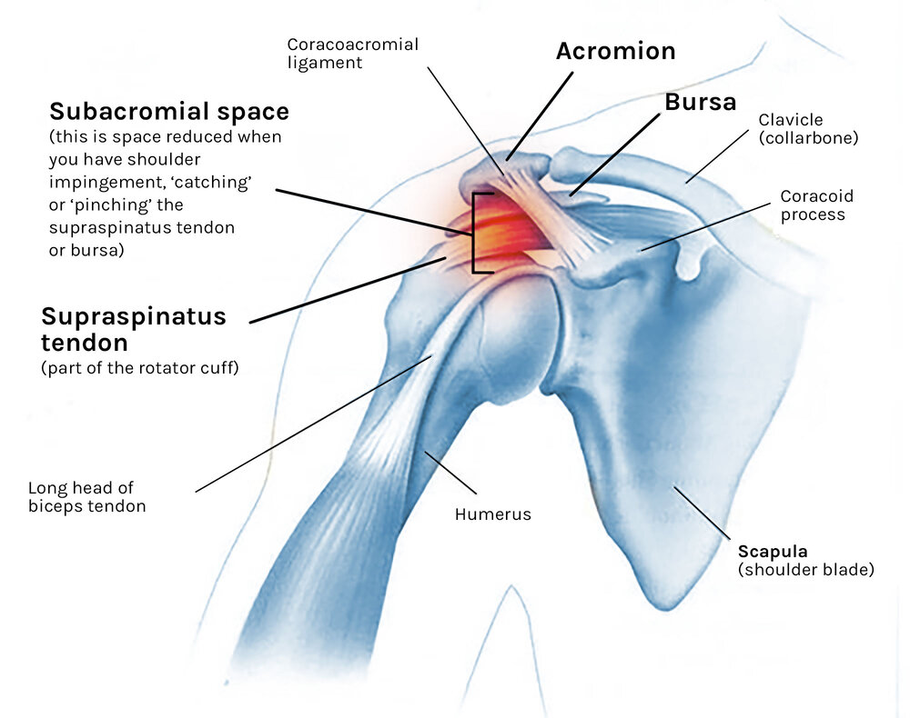 Shoulder Pain Without Injury? ProPhysio+