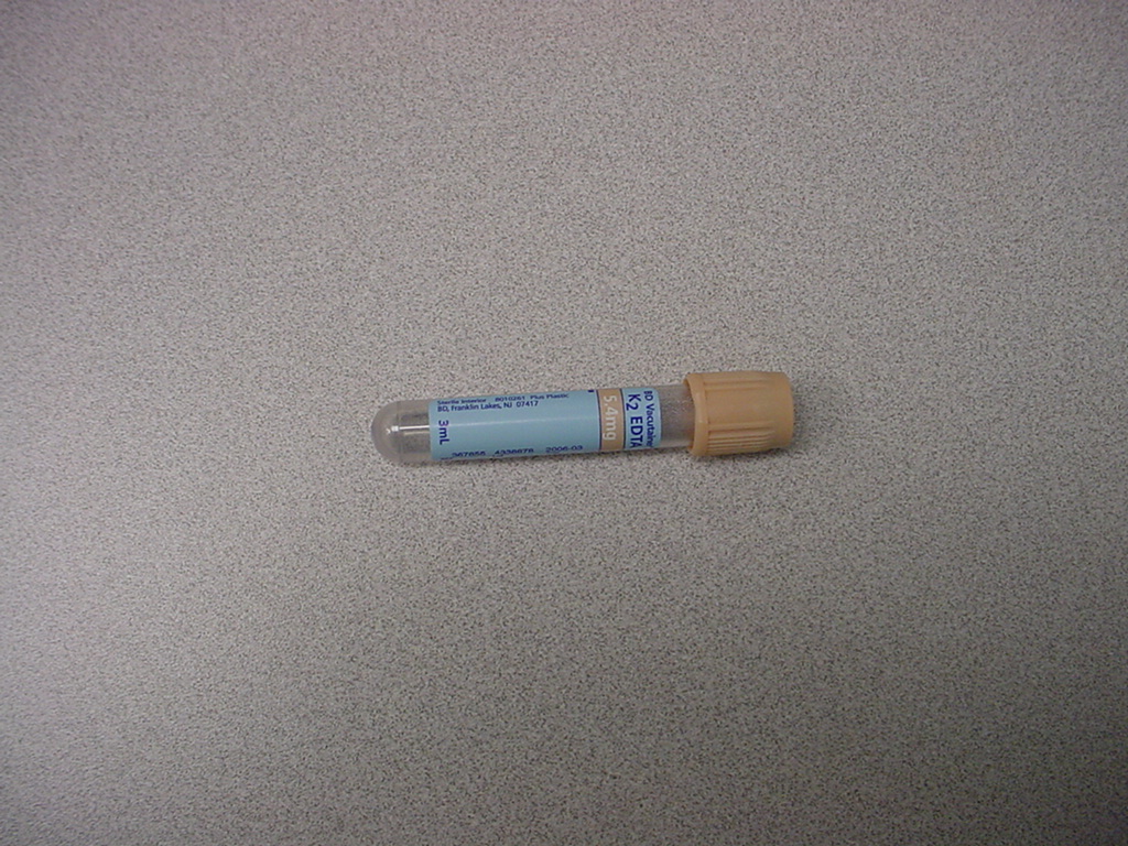 Triangle Tube Prestige Tech Support: August 2018