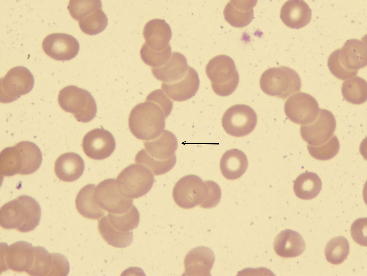 Parasitology Flashcards by ProProfs