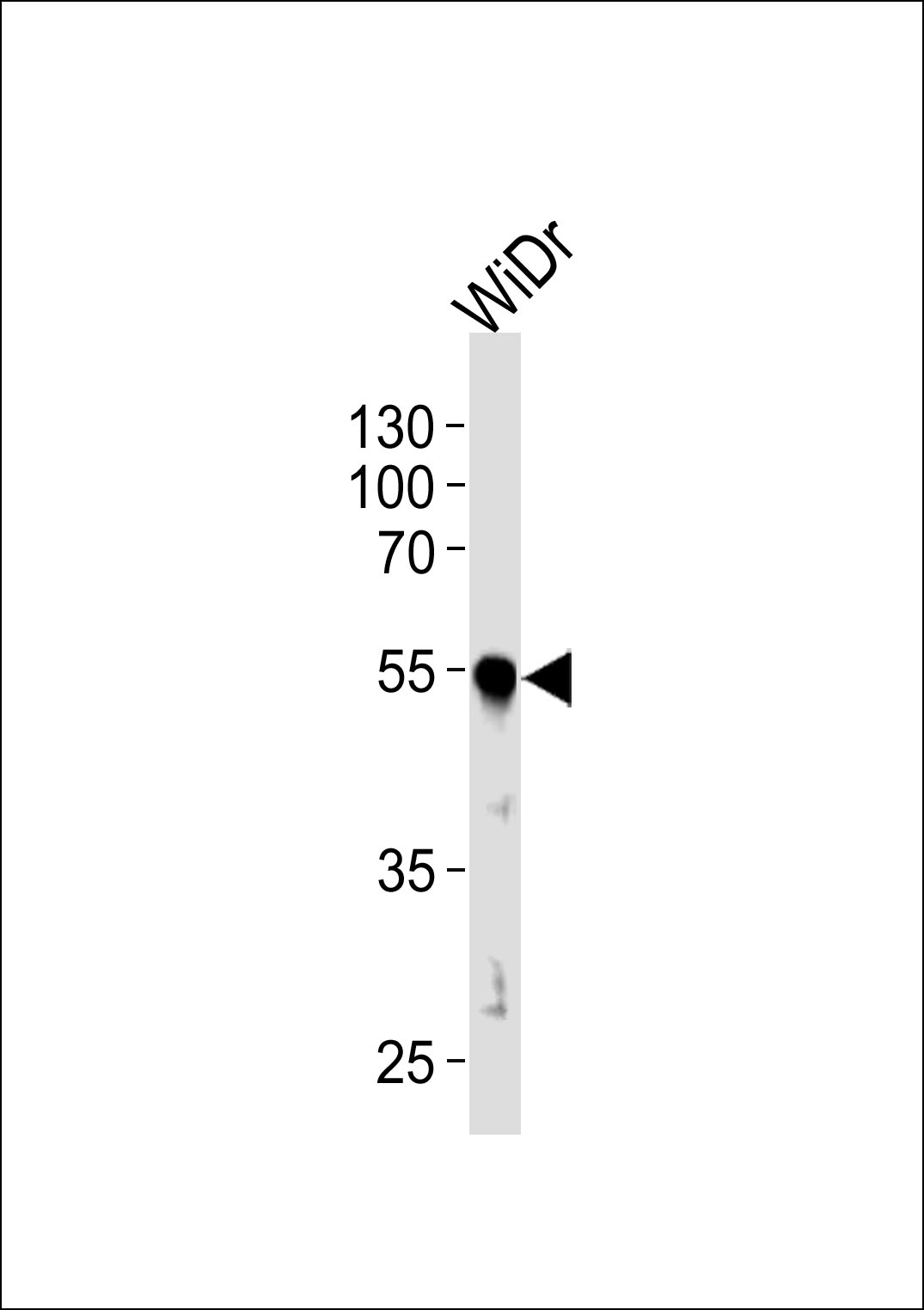 PDX1 Antibody - Cat. No. 60-968 | ProSci