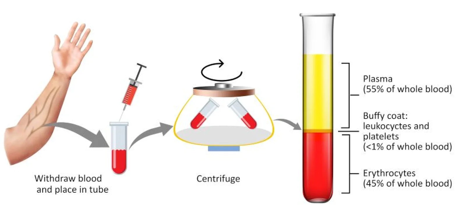PRP tube plasma rich platelet