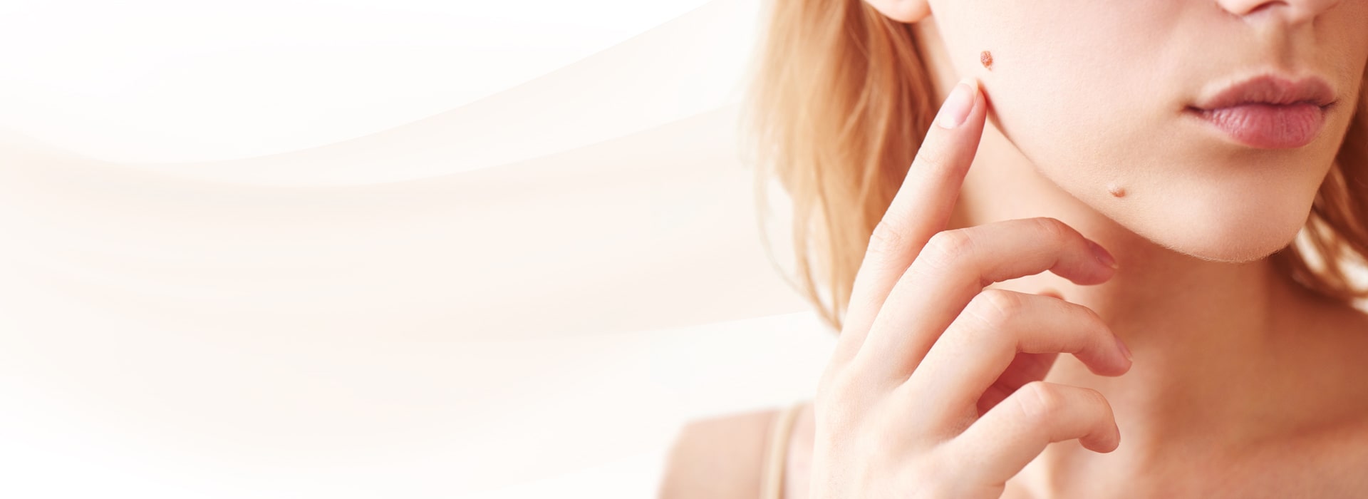 Laser Mole Removal Chicago Minimally Invasive and No