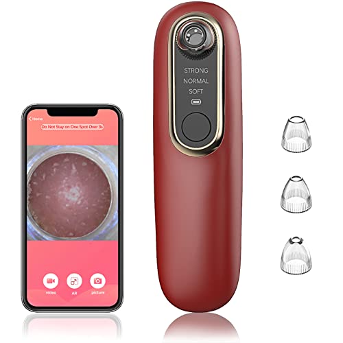 Best Pore Vacuum With Camera (2024 Update) Pubbelly
