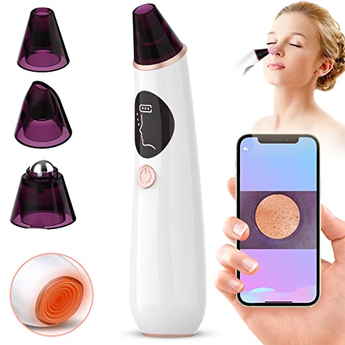 Best Pore Vacuum With Camera (2024 Update) Pubbelly
