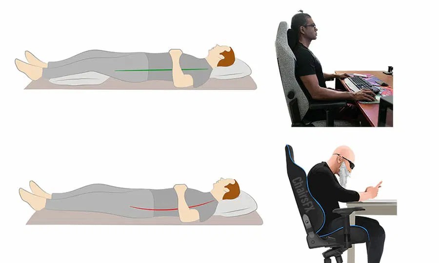 How To Sit and Sleep With Piriformis Syndrome Public Health