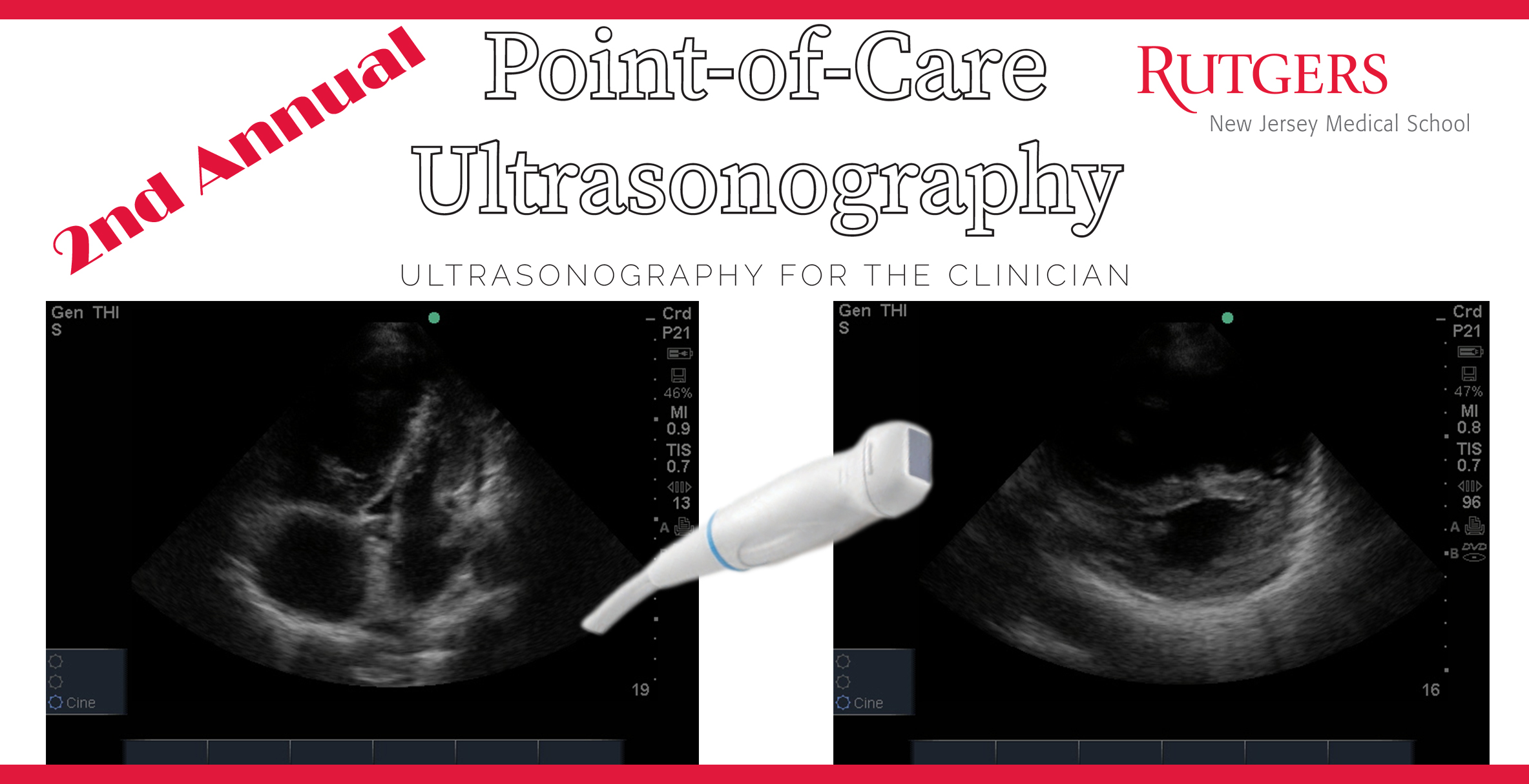 Event PointofCare Ultrasonography Association of Pulmonary