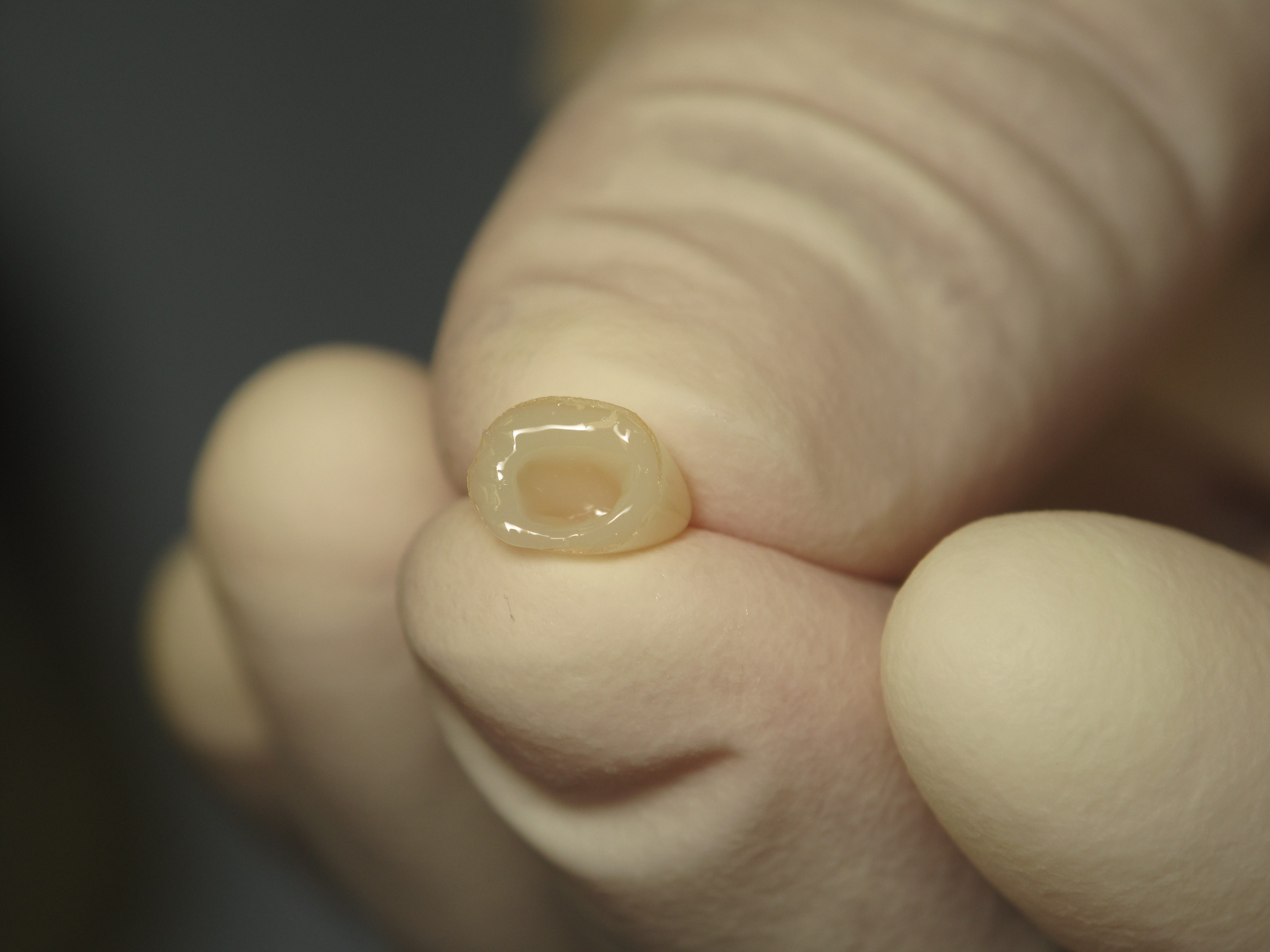 Direct From The Operatory Strip Crowns and ACTIVA KIDS PULPDENT