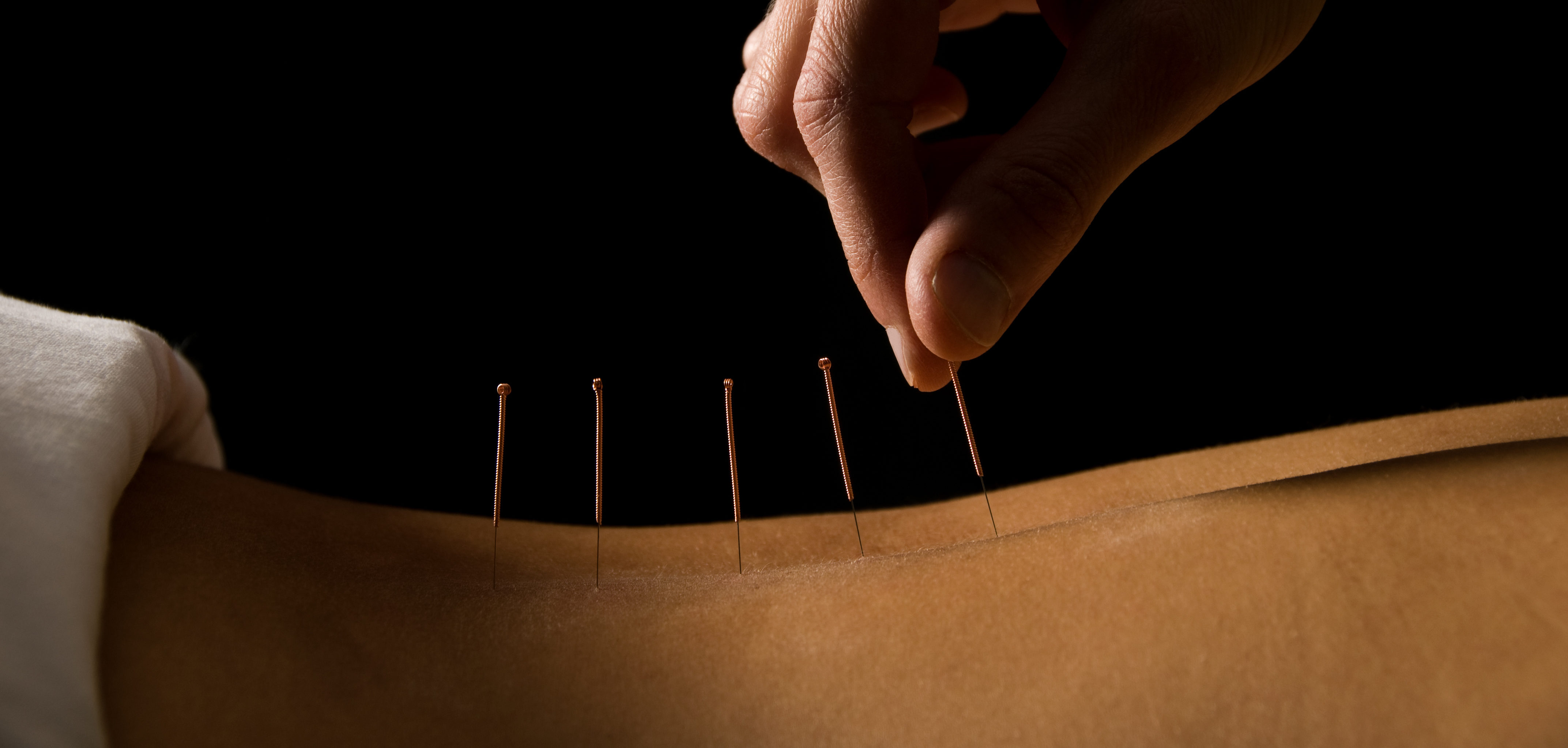 Acupuncture vs. Acupressure What You Need to Know Purple Carrot