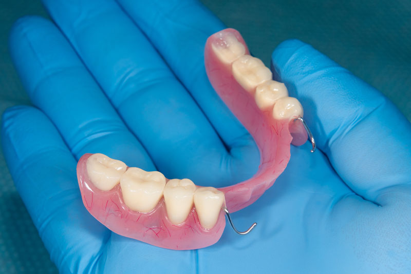Full Denture Partial Dentures Mount Laurel, NJ