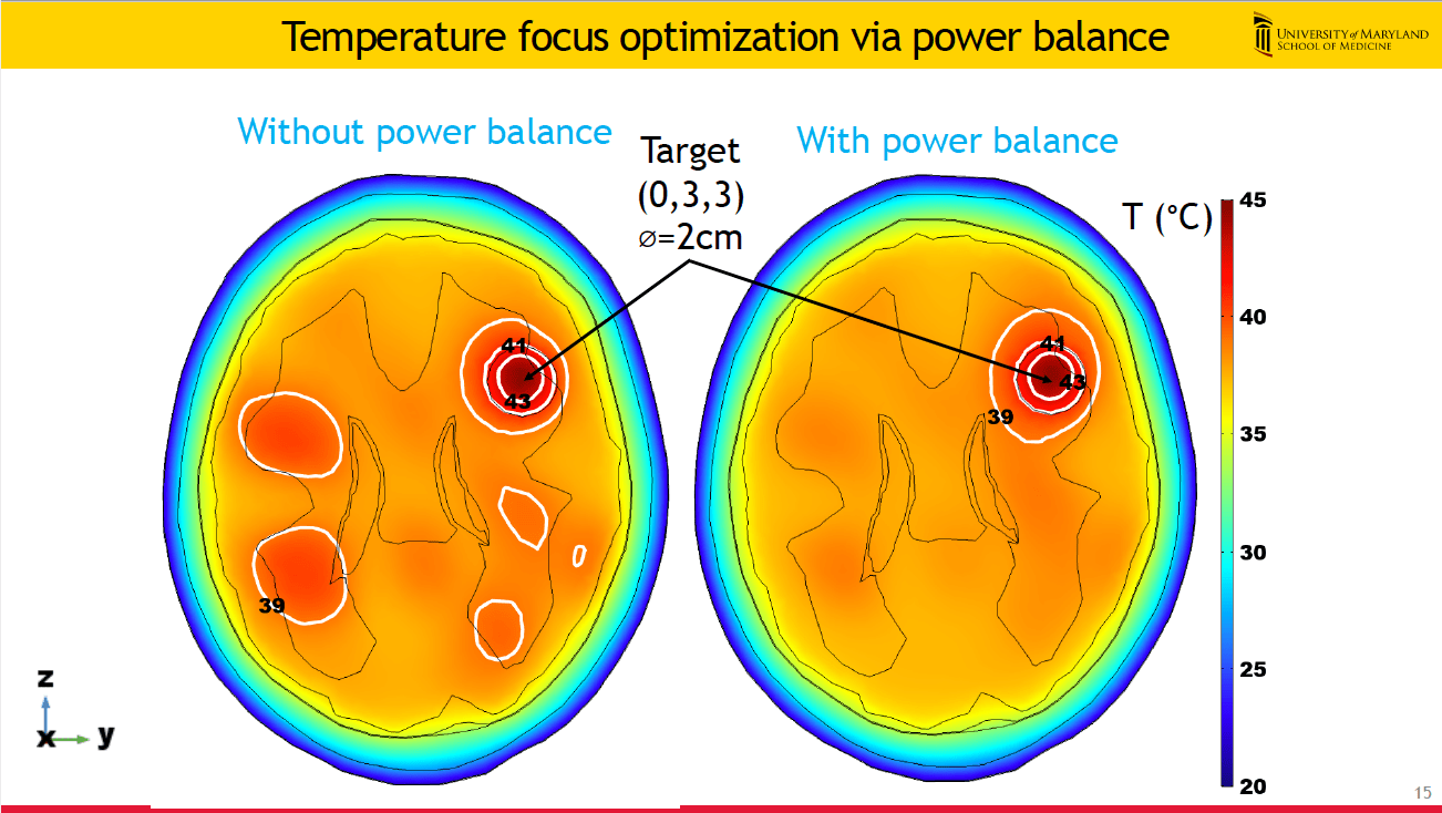 Paving the Way for Brain Cancer Treatment.
