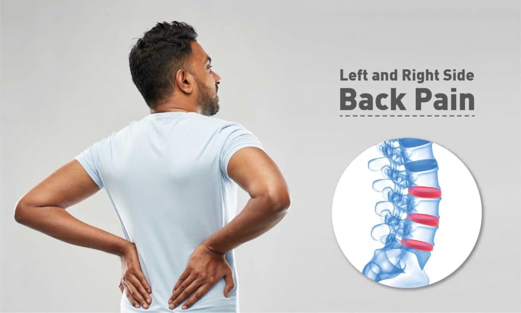 Left and Right Side Back Pain Treatment, Causes & Diagnosis QI Spine