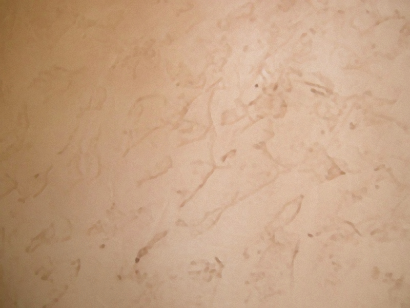 Drywall and Texturing