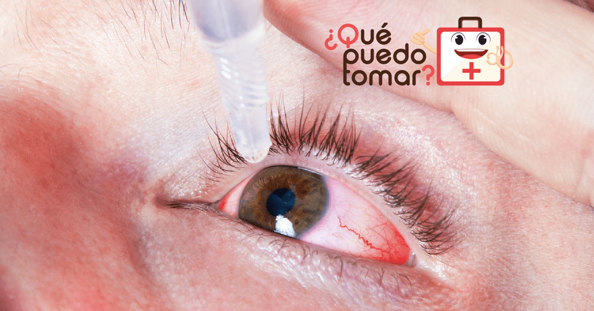 Medicamentos para la presión ocular, te decimos cuáles son los mejores