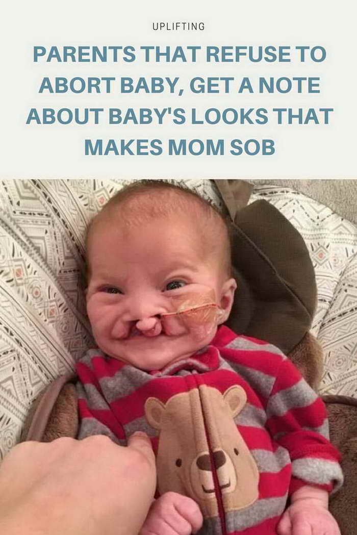 Parents That Refuse To Abort Baby, Get A Note About Baby's Looks That