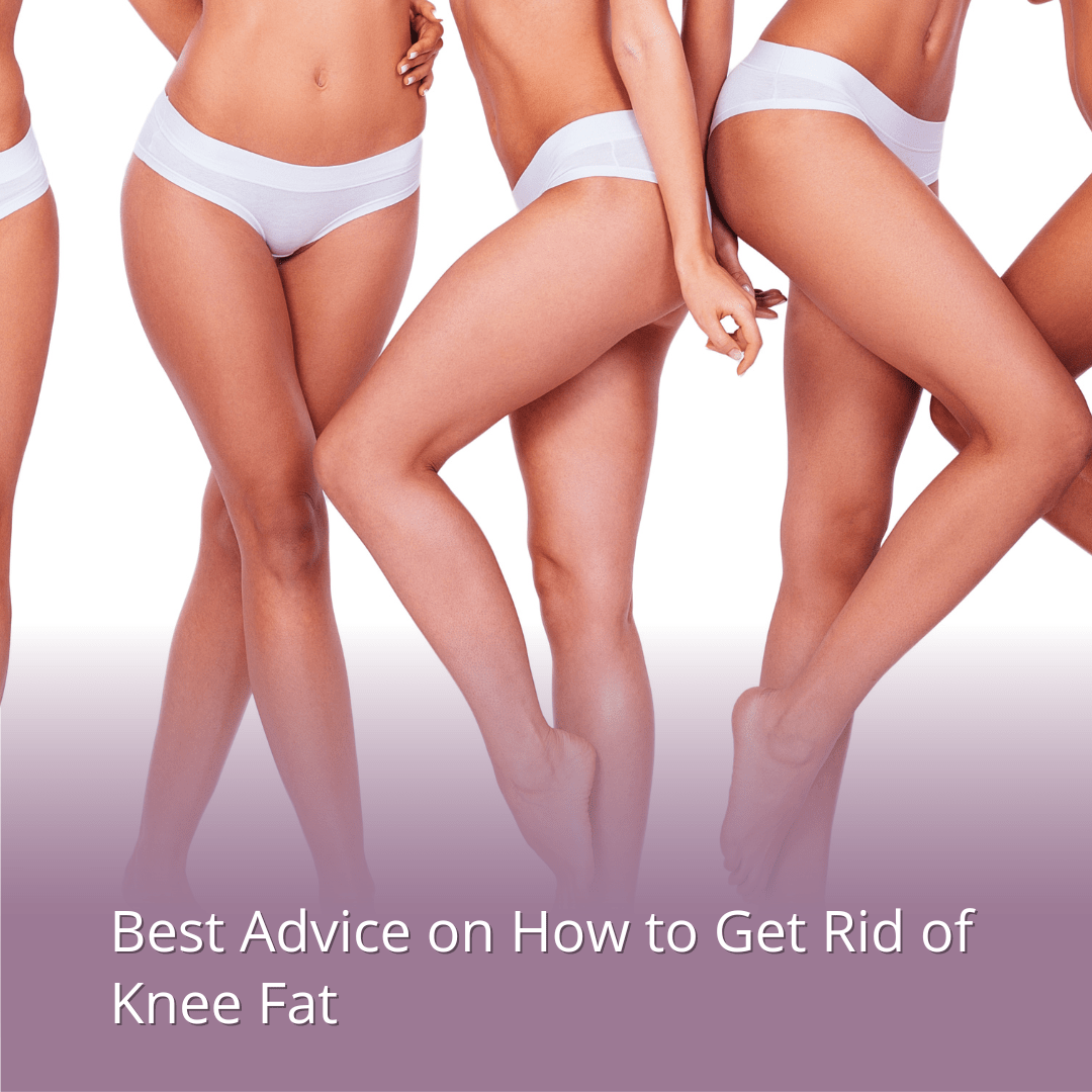 Best Advice on How to Get Rid of Knee Fat Rachael Attard