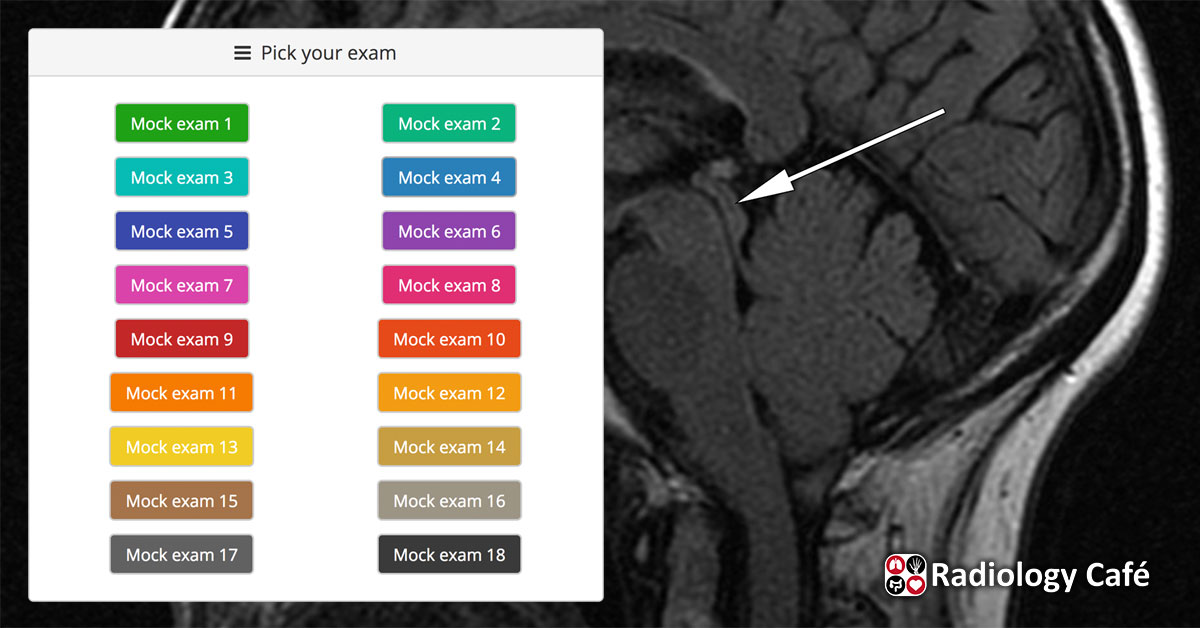 Mock anatomy exams Radiology Cafe