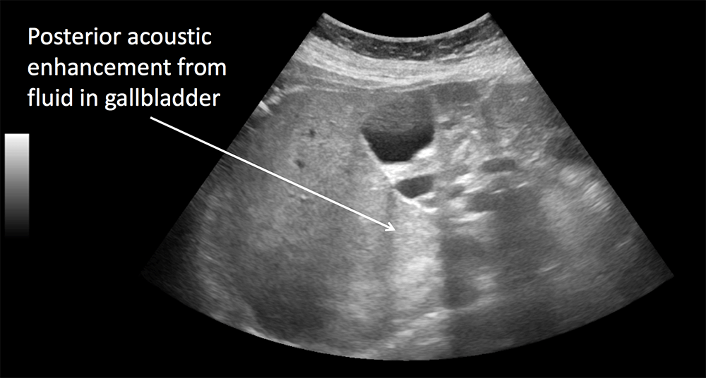 US artefacts Radiology Cafe