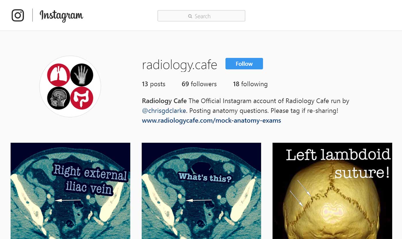 Radiology taster week experience Radiology Cafe