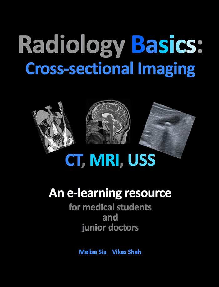 Radiology Basics Radiology Cafe