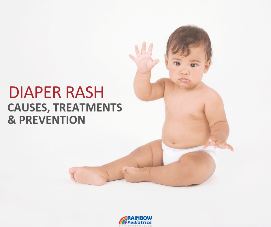 Diaper Rash Causes, Treatments, & Prevention Rainbow Pediatrics
