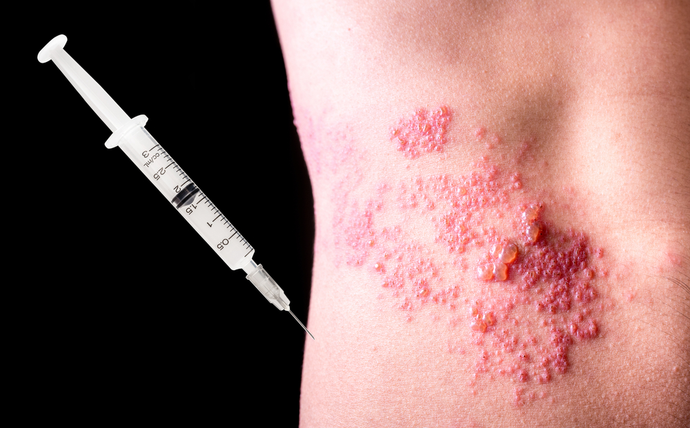 This New Shingles Vaccine is Amazingly Effective, According to Experts RateMDs Health News