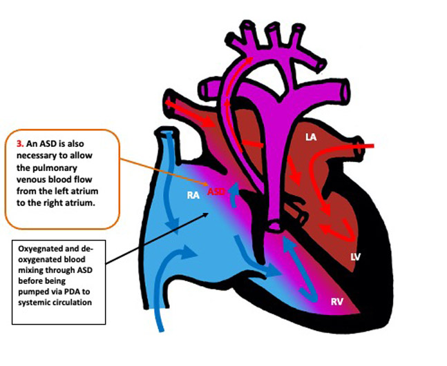 Pathophysiology RCEMLearning India