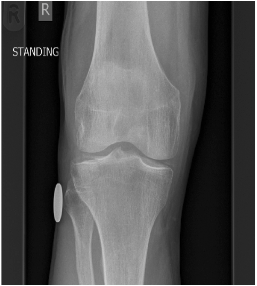 The acutely injured knee RCEMLearning India