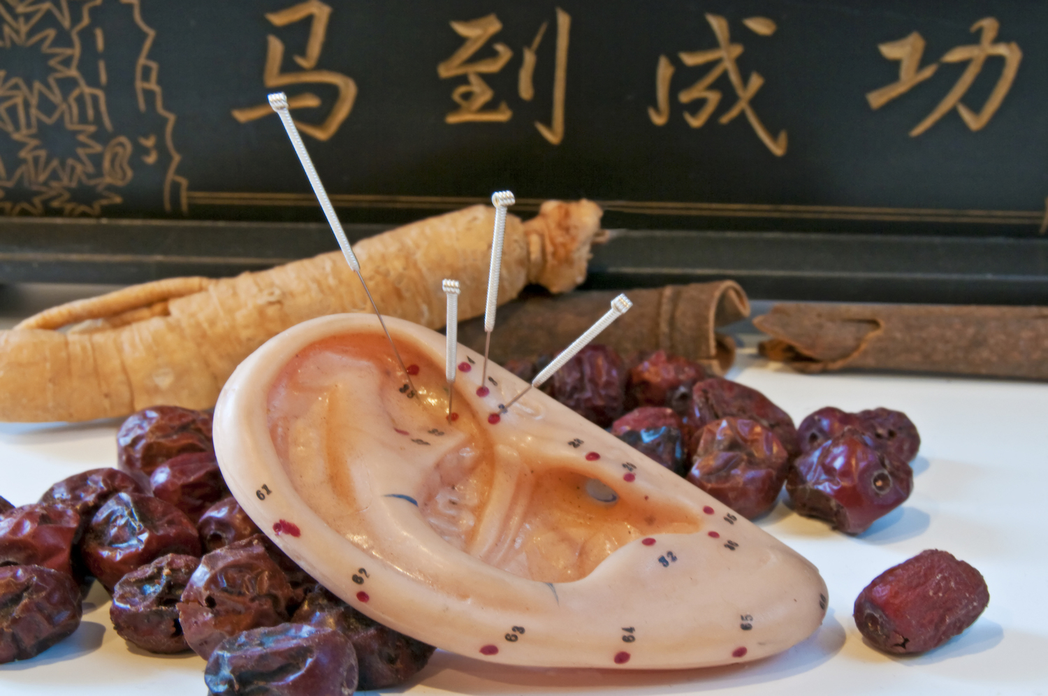 Acupuncture Louisville KY River City Wellness Restoring Balance