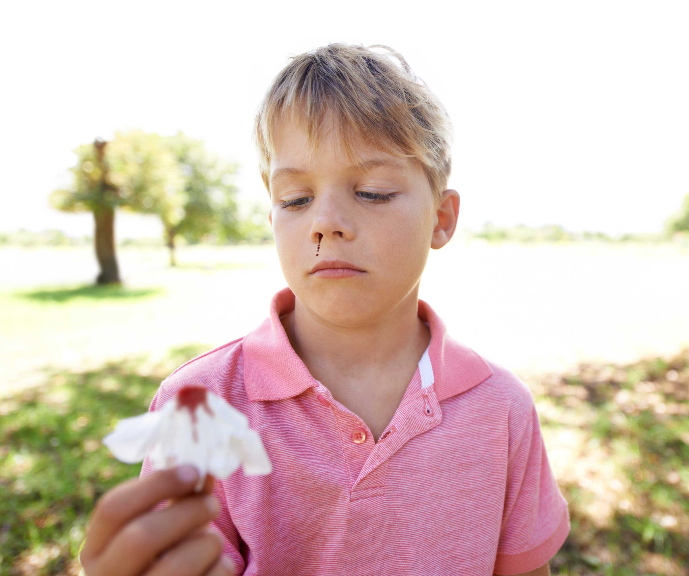 How To Of The Day How To Stop A Nosebleed Common Sense