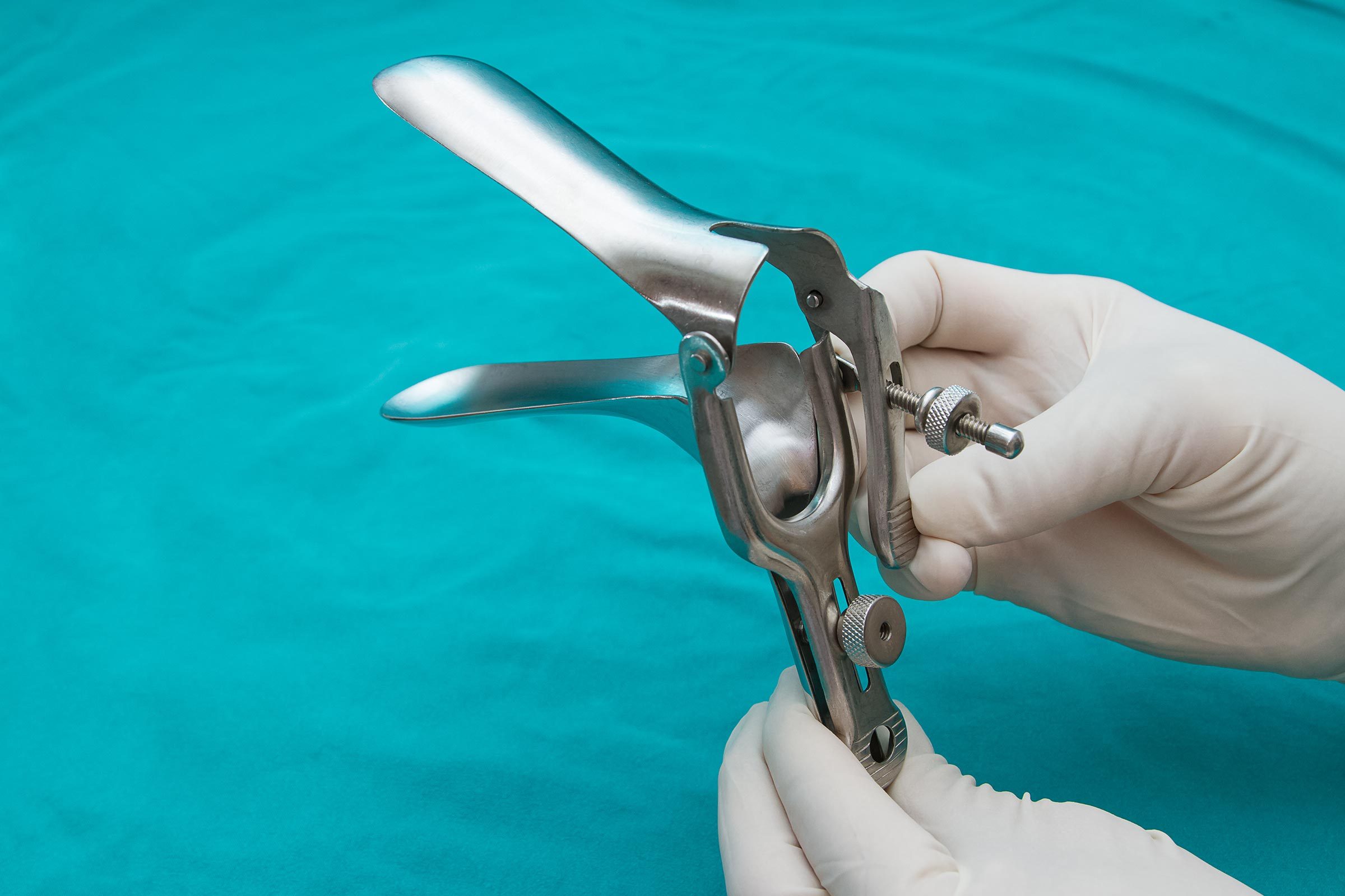 Cervical Cancer What Doctors Wish You Knew The Healthy