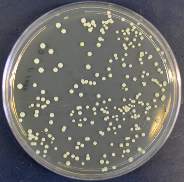 Petri Dish analysis Reactiv IP