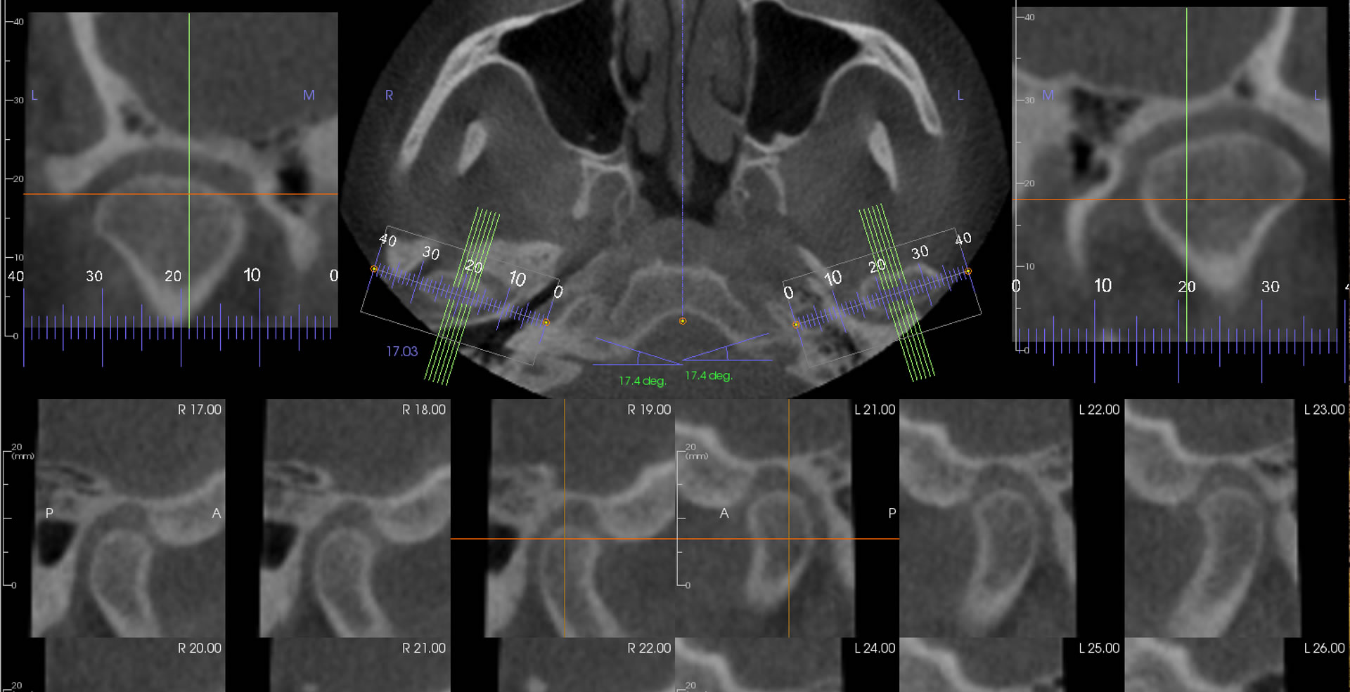 Dental and Maxillofacial Radiology Omaha