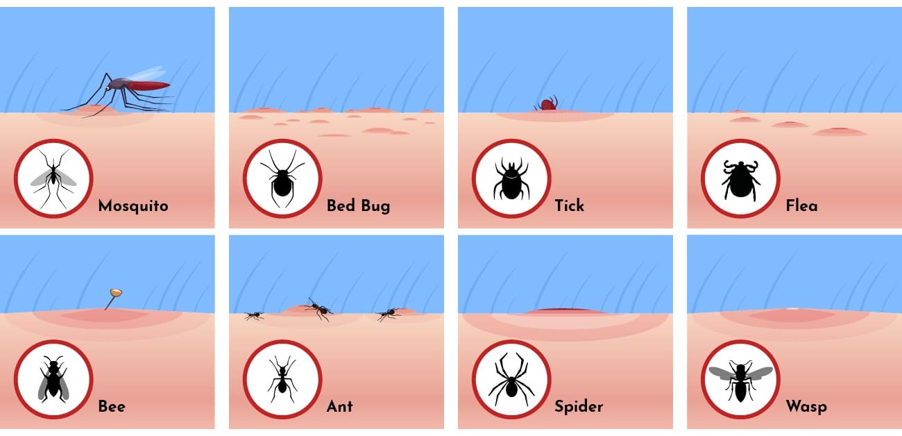 What Bit Me? The Ultimate Guide to Bites and Stings Really Helpful Club