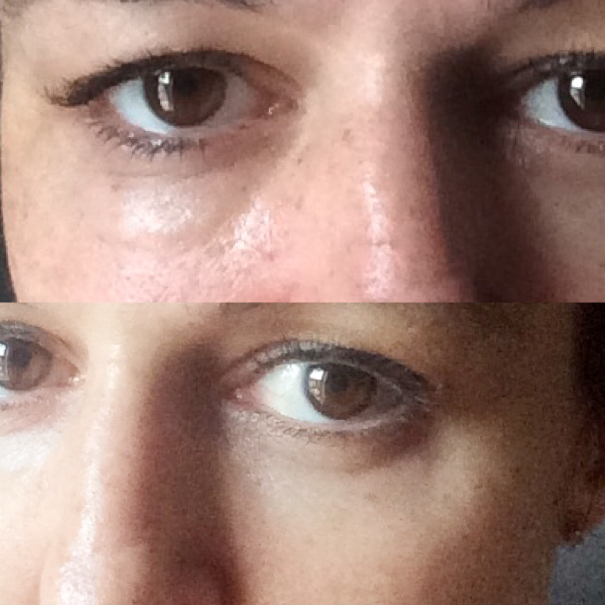 Eye Puffiness Minimising Patches by Masque Bar Really Ree