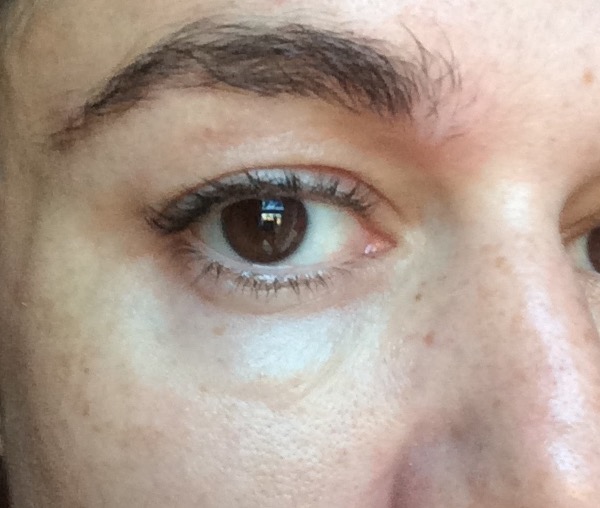 OptimEyes Patches Review Really Ree