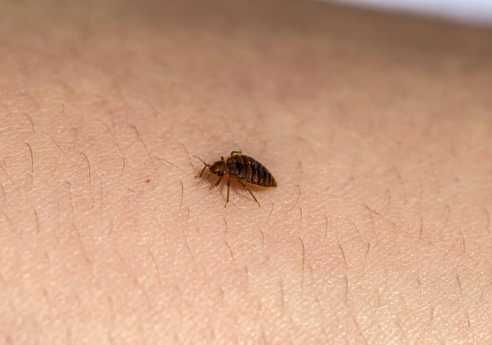 Can Bed Bugs Bite Through Clothing? (Symptomes & Home Remedy)