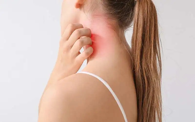 Red Light Therapy for Psoriasis and Eczema A Detail Guide