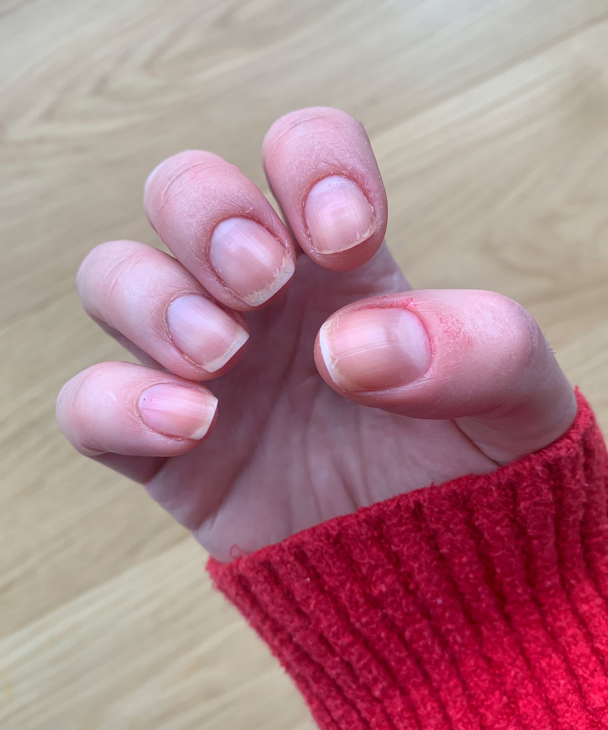 Is It Bad To Keep Your Nails Painted at Zane Stirling blog
