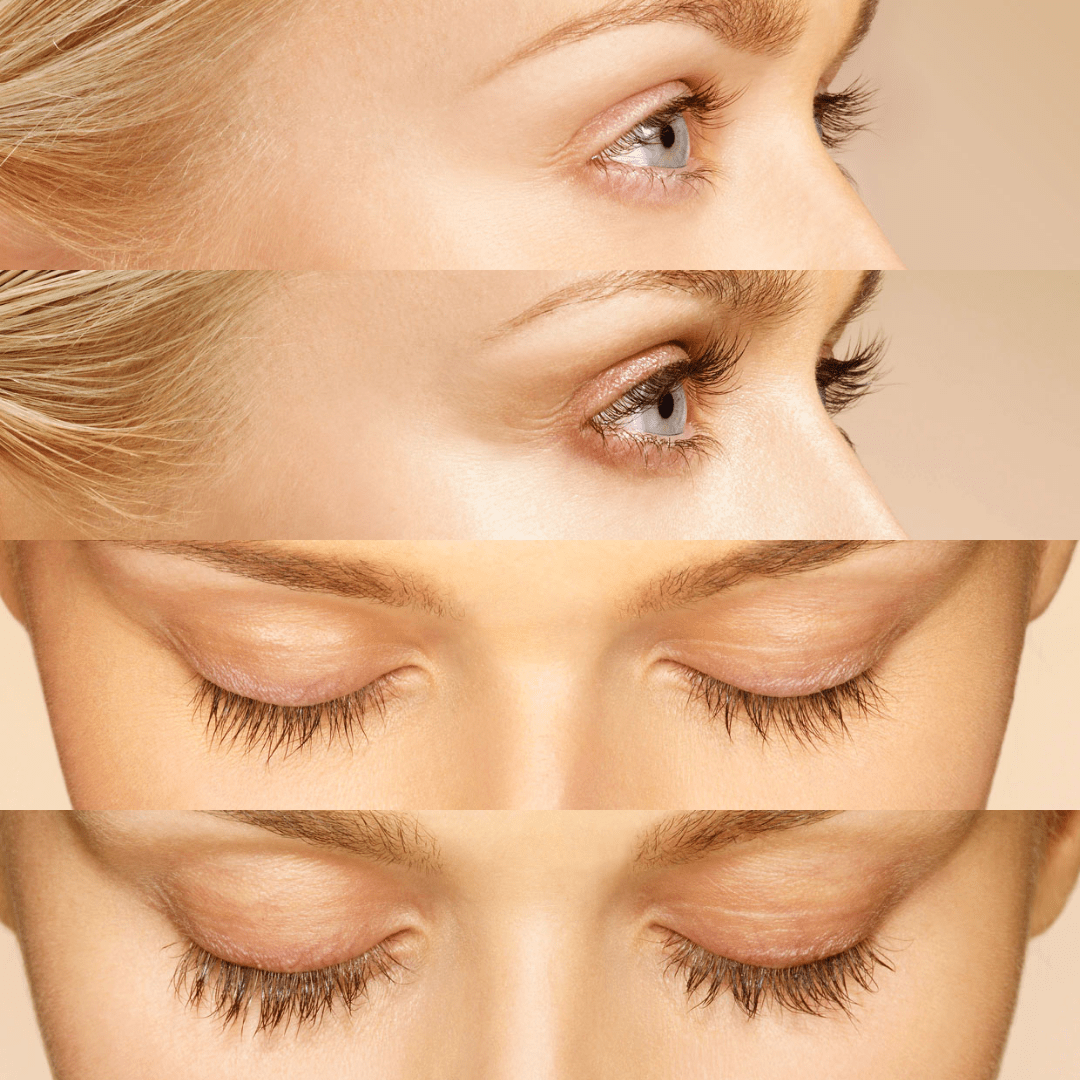 Latisse Eyelash Lengthening Results for Blonde Woman in Her 30's Before